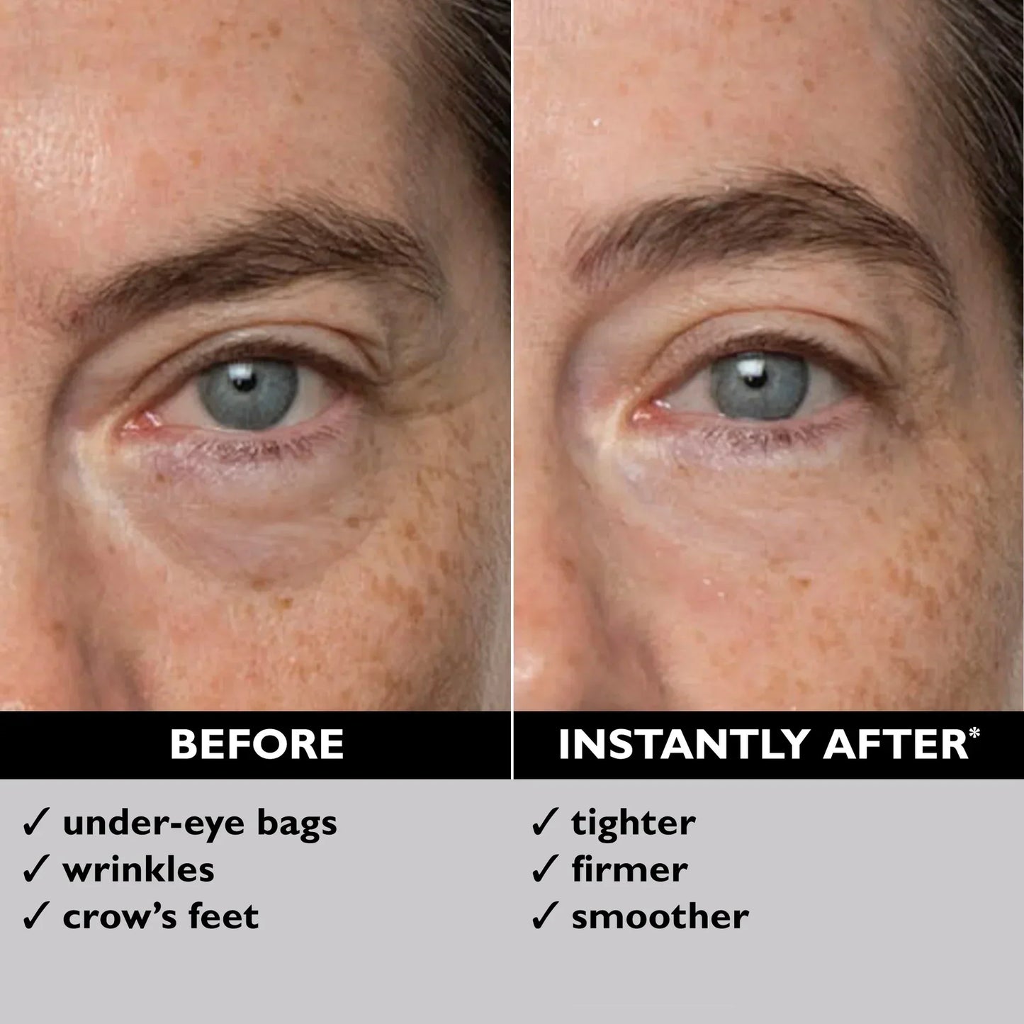 💖 Eye Bag Eraser-Say Goodbye to Puffy Eyes and Wrinkles in Just 15 Minutes!