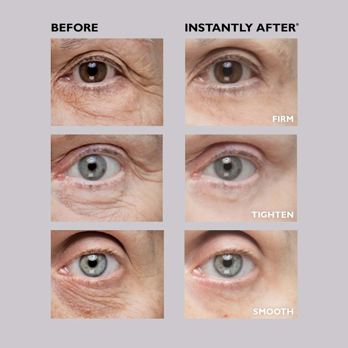 💖 Eye Bag Eraser-Say Goodbye to Puffy Eyes and Wrinkles in Just 15 Minutes!