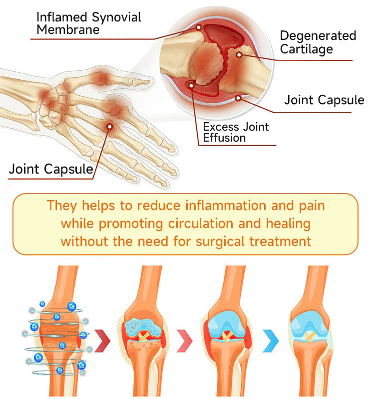 Botulinum and Bee Toxin Pain Relief Bone Healing Cream