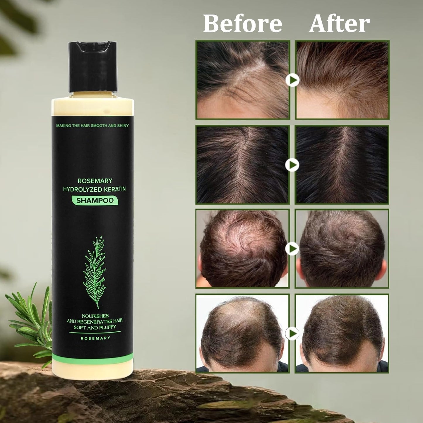 đ2026âšLAST DAY SALE 70% OFF!đOrganic Rosemary Hair Growth Shampoo