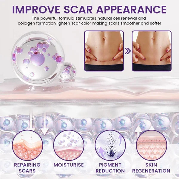 ReGenScar Stem Cell Scar Gel