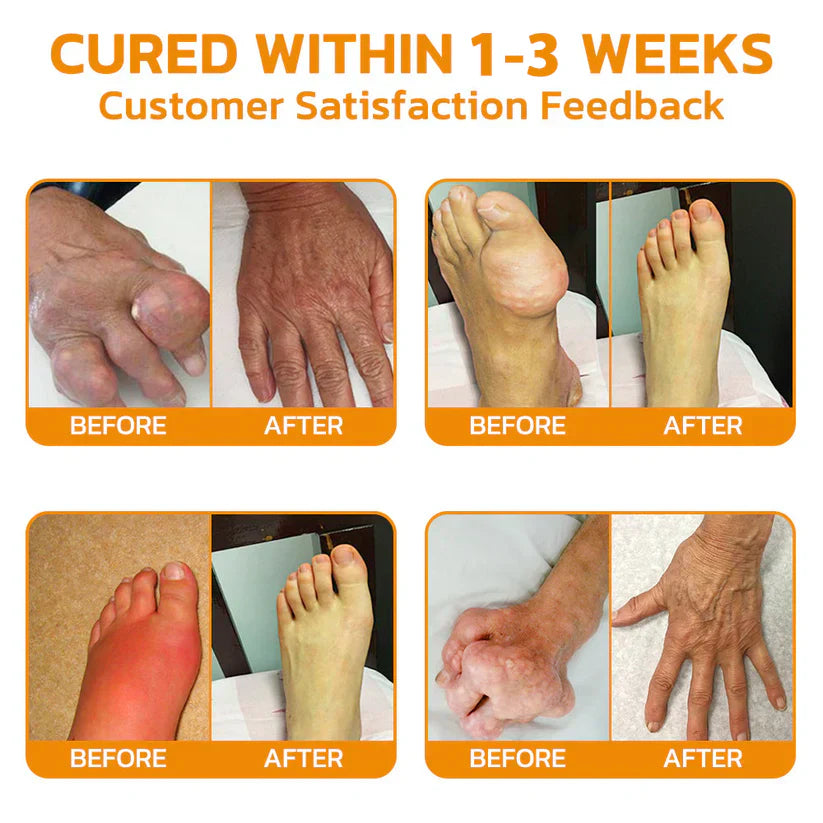 Botulinum and Bee Toxin Pain Relief Bone Healing Cream