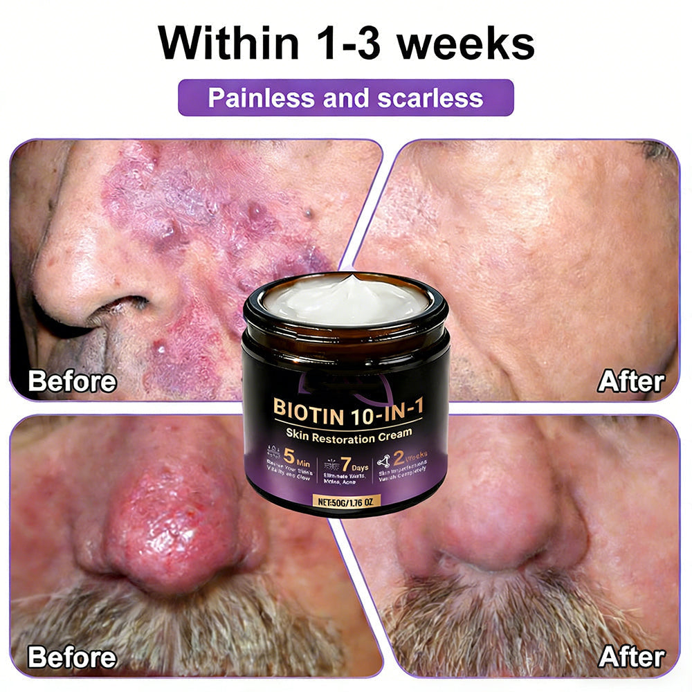 🎁✨Made and Shipped from USA ✨Biotin 10-in-1 Skin Restoration Cream 🍀