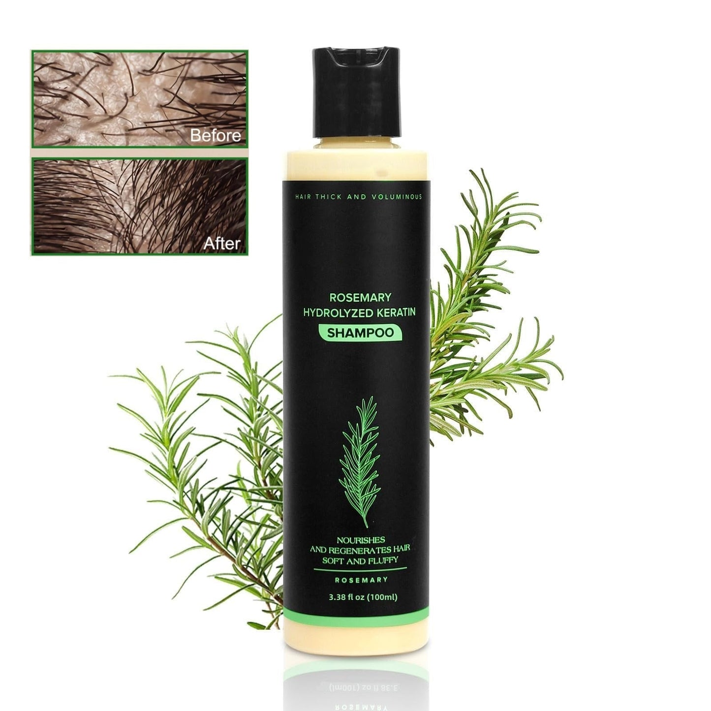 👑2026✨LAST DAY SALE 70% OFF!🏆Organic Rosemary Hair Growth Shampoo