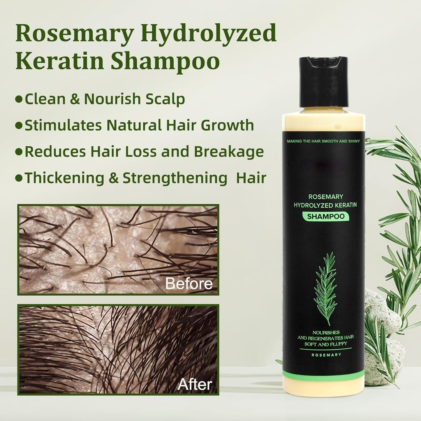 👑2026✨LAST DAY SALE 70% OFF!🏆Organic Rosemary Hair Growth Shampoo