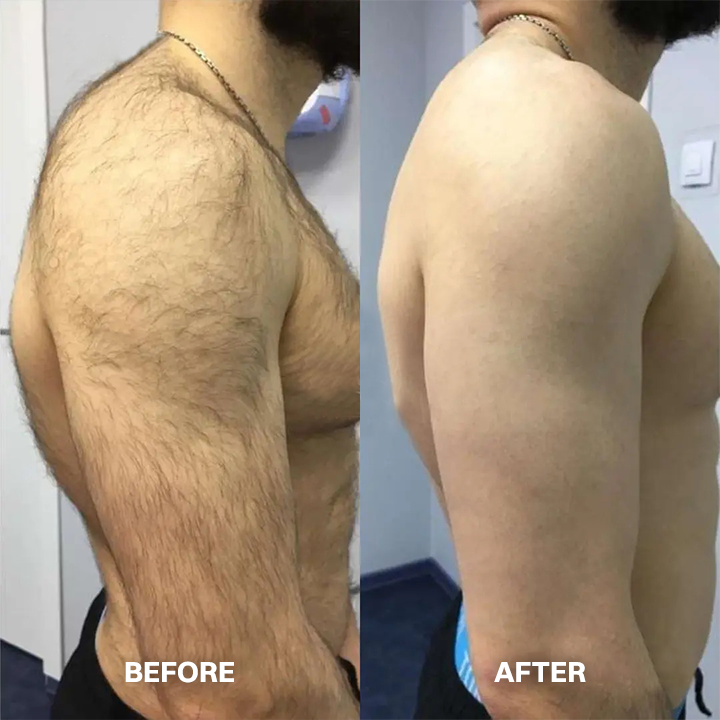 Hair Removal Cream for All Women & Men