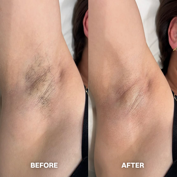 Hair Removal Cream for All Women & Men