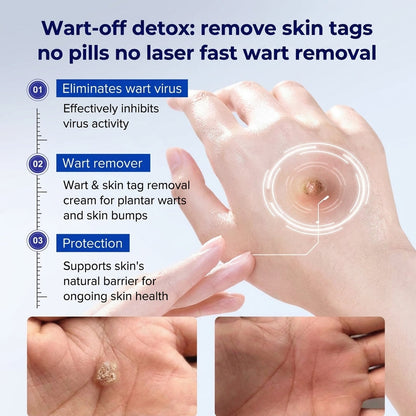 🖊 Advanced Wart & Skin Tag Removal Pen