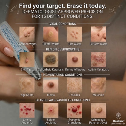 🖊 Advanced Wart & Skin Tag Removal Pen